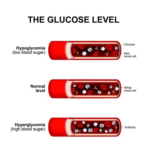 Obesity and Blood Sugar